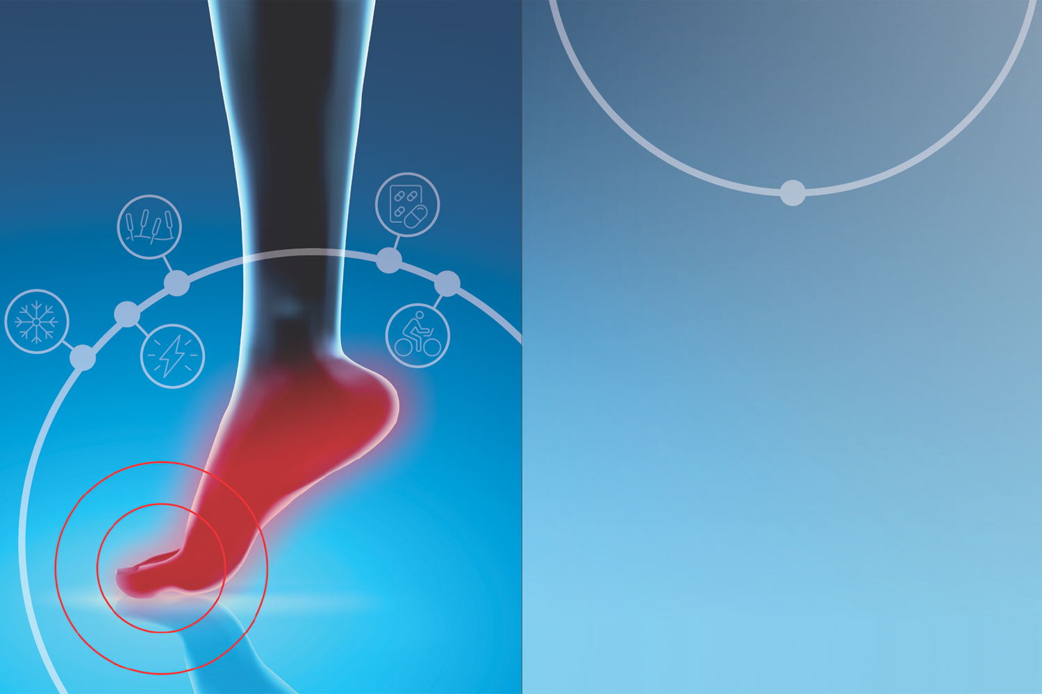 Heel Pain: Causes, Treatments and Prevention - Apollo Hospitals Blog