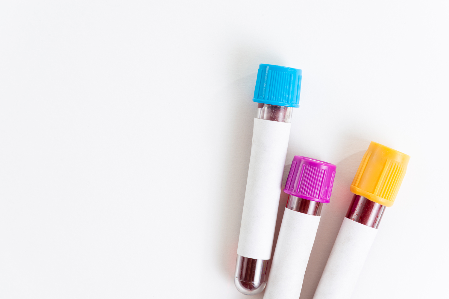 What Is Liquid Biopsy?