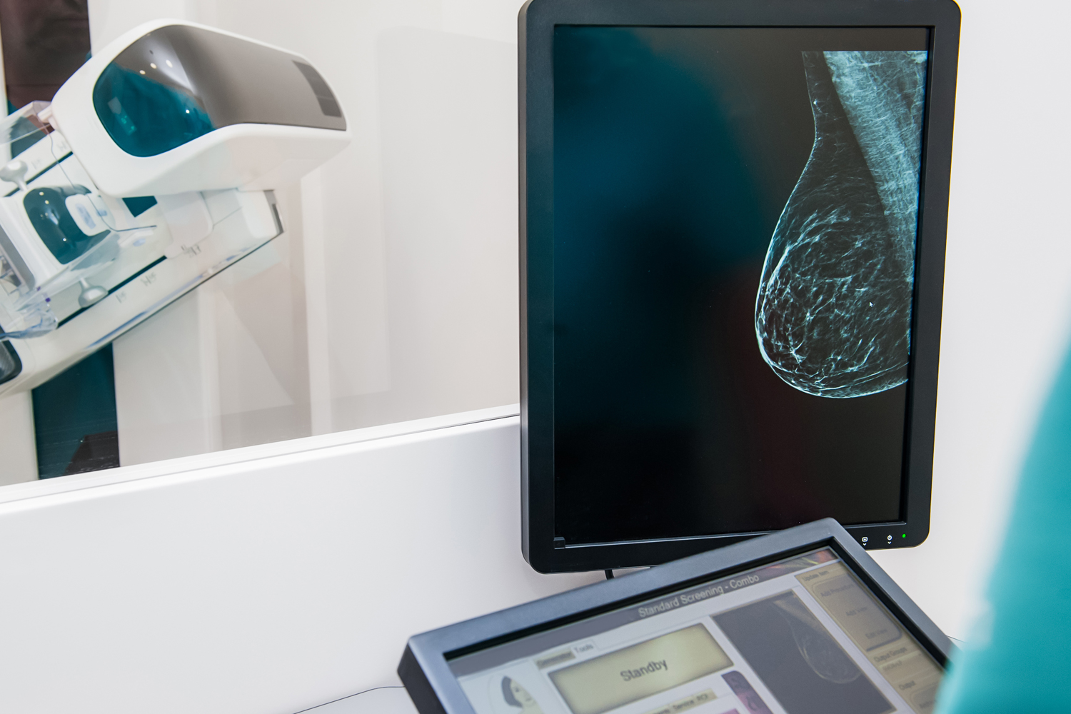 Understanding the Federal Rule on Breast Tissue Density Reports