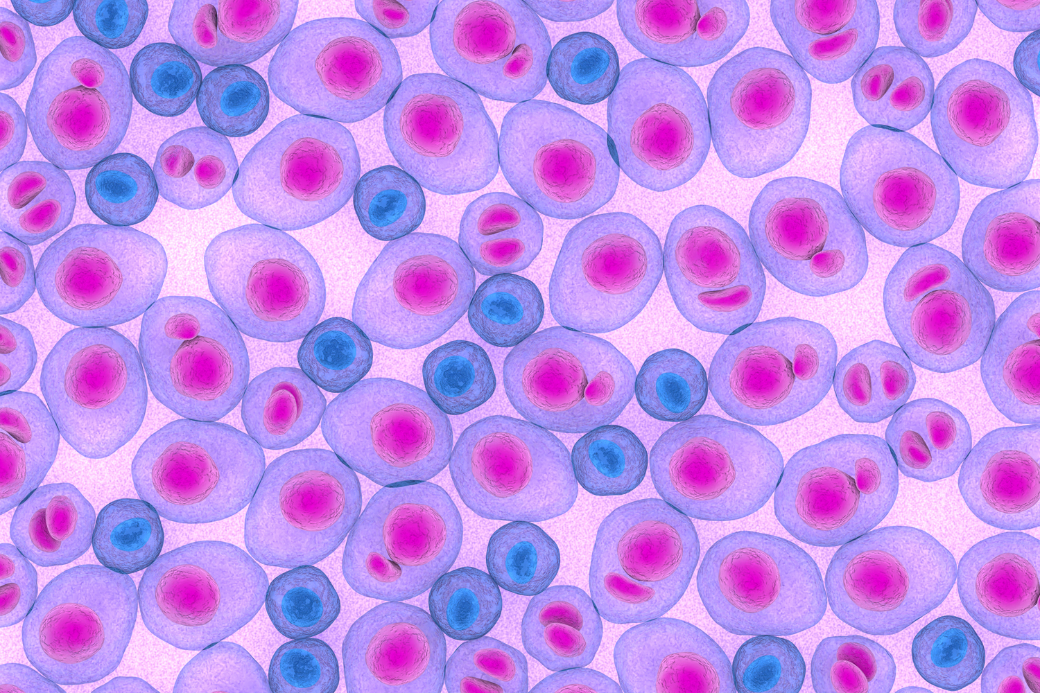 Speeding Up Multiple Myeloma Drug Development