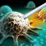 Mobilizing an Immune Response in Metastatic Prostate Cancer