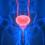 Immunotherapy Improves Survival in Bladder Cancer